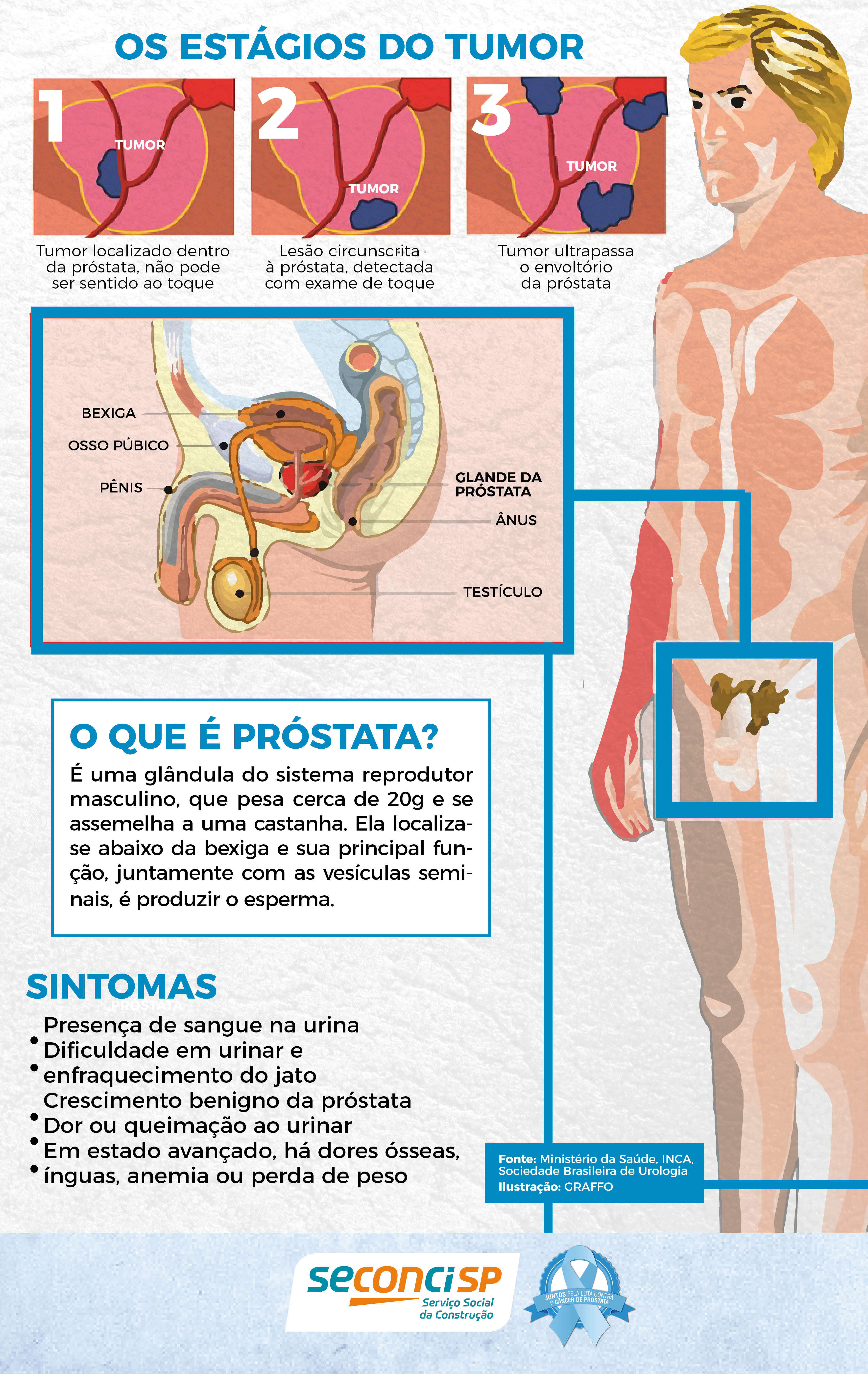 Novembro Azul - Todos na luta contra o câncer de próstata - Seconci-SP